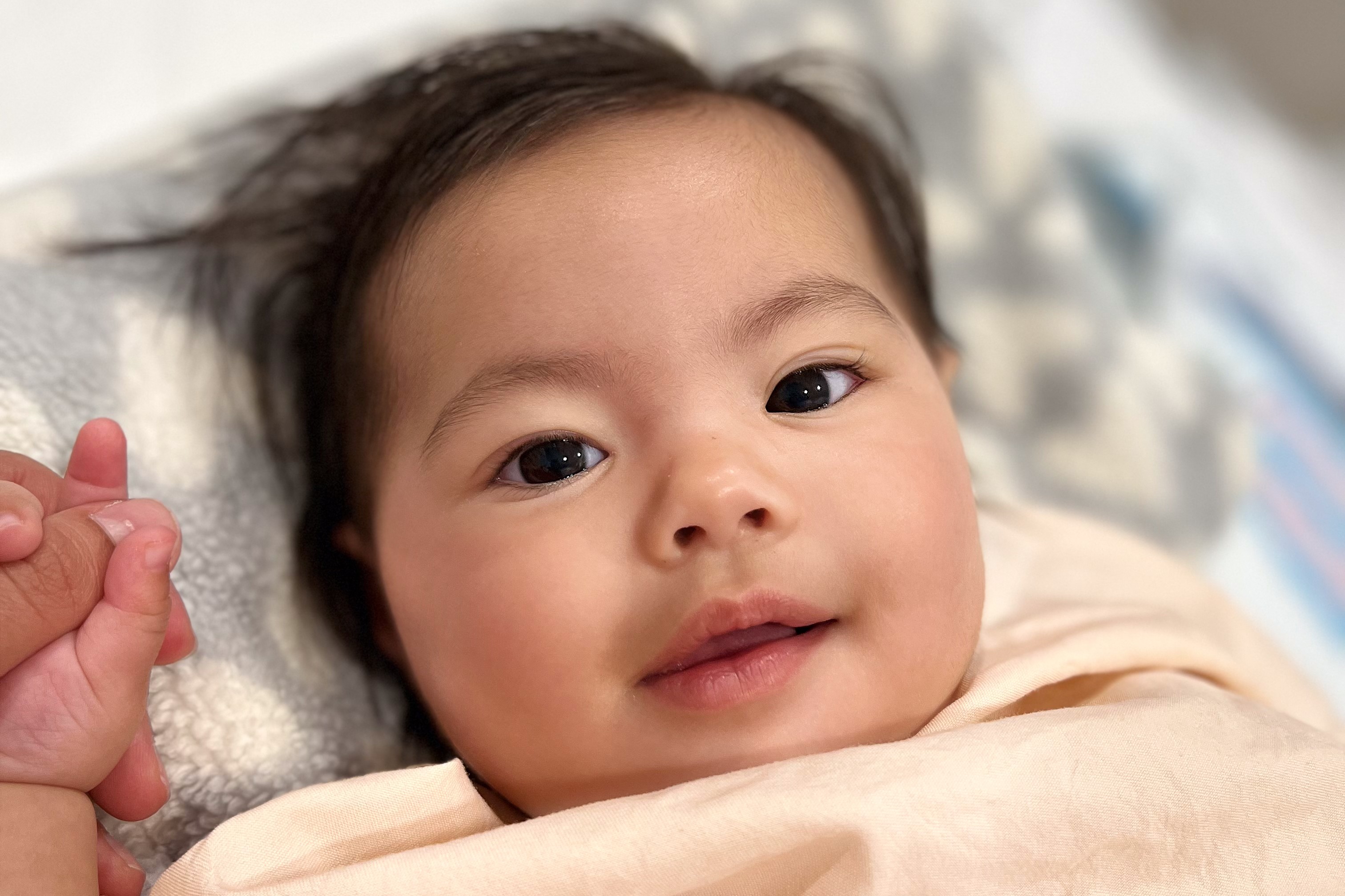 Selena's Hip Dysplasia Journey